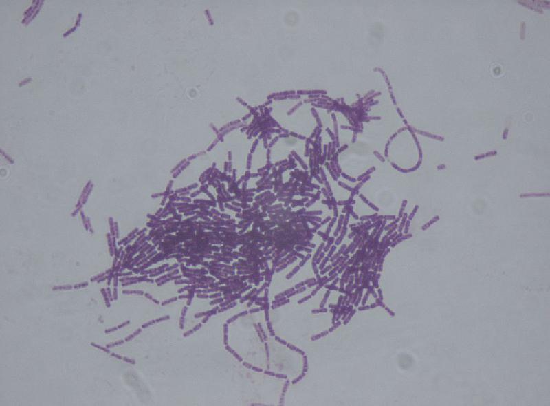 Fichier:Image Pratiquer la lutte biologique l aide de microorganismes.jpg