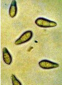 Fichier:Maladies-pyriculariose spores Webinaire-Terre-net-CIRAD.jpg