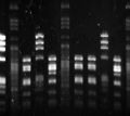 Electrophorèse d'ADN microbien