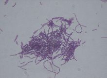 Image Pratiquer la lutte biologique l aide de Bacillus thuringiensis.jpg